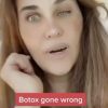 When Using Botox Goes Wrong!