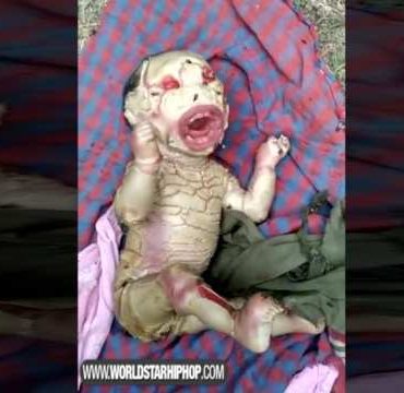 Whoa: Extraterrestrial Looking Baby Born In India!