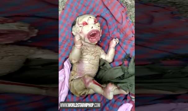 Whoa: Extraterrestrial Looking Baby Born In India!