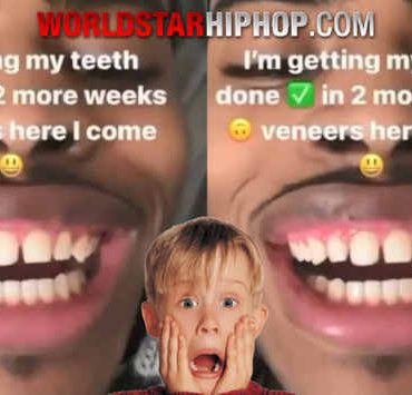 All Dentists Are Not Created Equal.. Buddy Flew Out To Get Veneers And Instantly Regretted His Decision!
